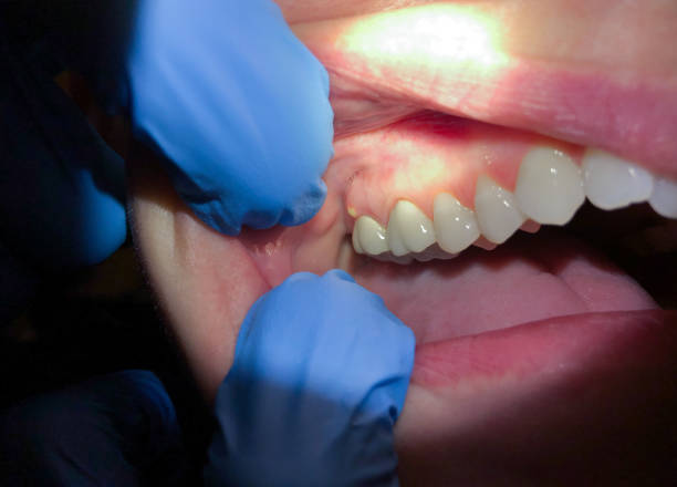 Best After-Hours Dental Trauma Care in Oakdale, MN